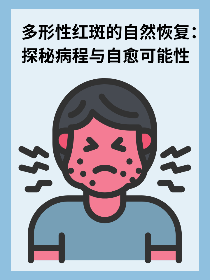 三生国健：公司战略聚焦在自身免疫性疾病领域