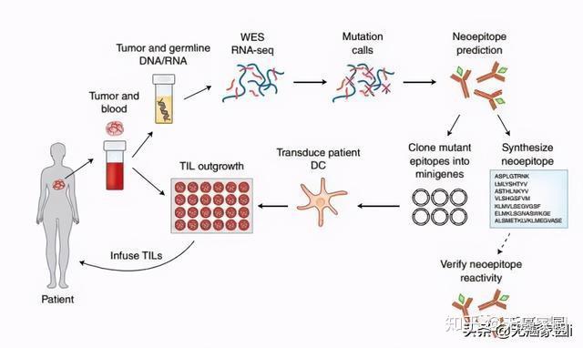 美中嘉和：完成全国首例脉络膜恶性黑色素瘤质子治疗
