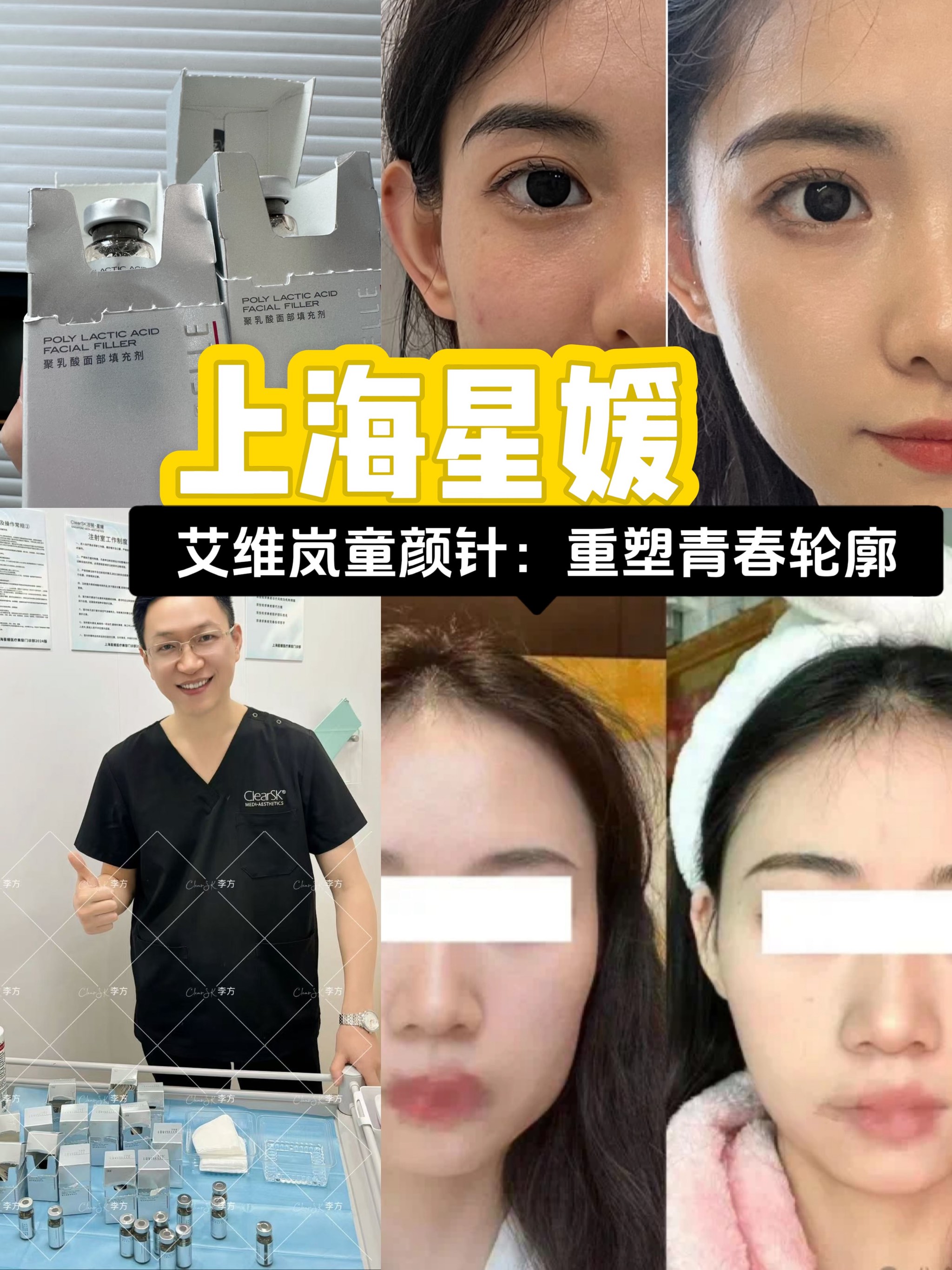 争夺艾塑菲中国代理权，谁更需要“童颜针”