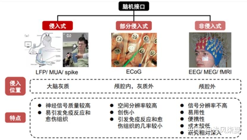 脑机接口迎来技术奇点？