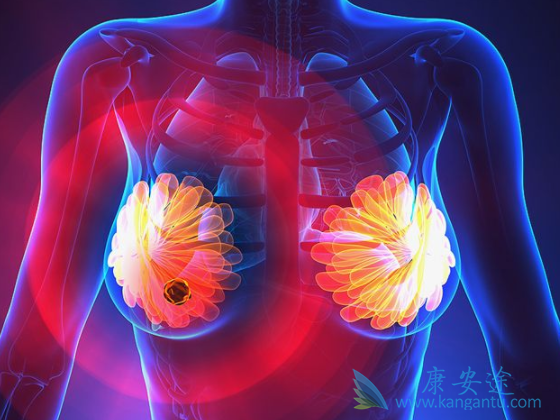 百利天恒：iza-bren用于局部晚期或转移性三阴乳腺癌III期临床试验的期中分析达到主要终点