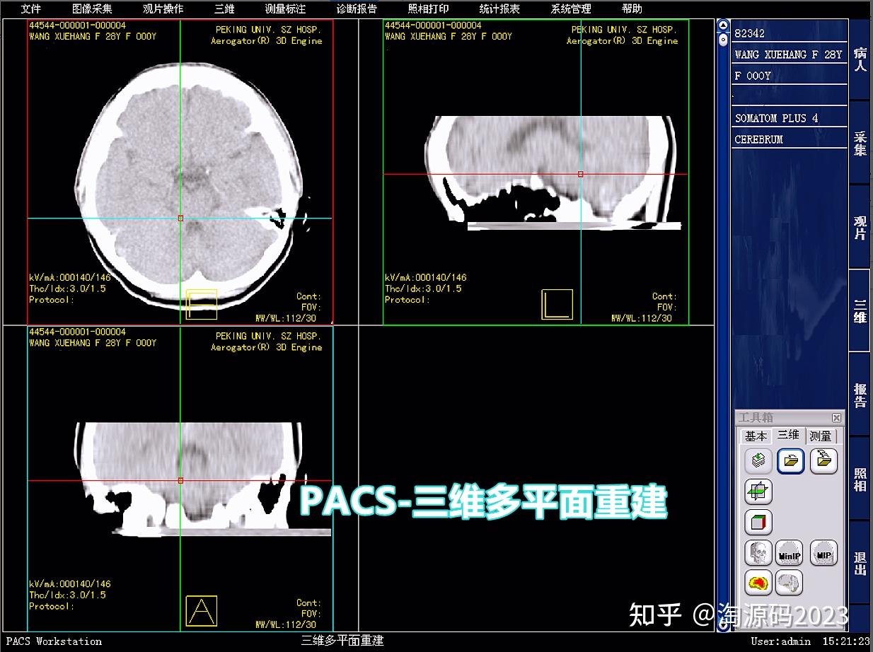 联影医疗获得发明专利授权：“一种图像重建系统和方法”