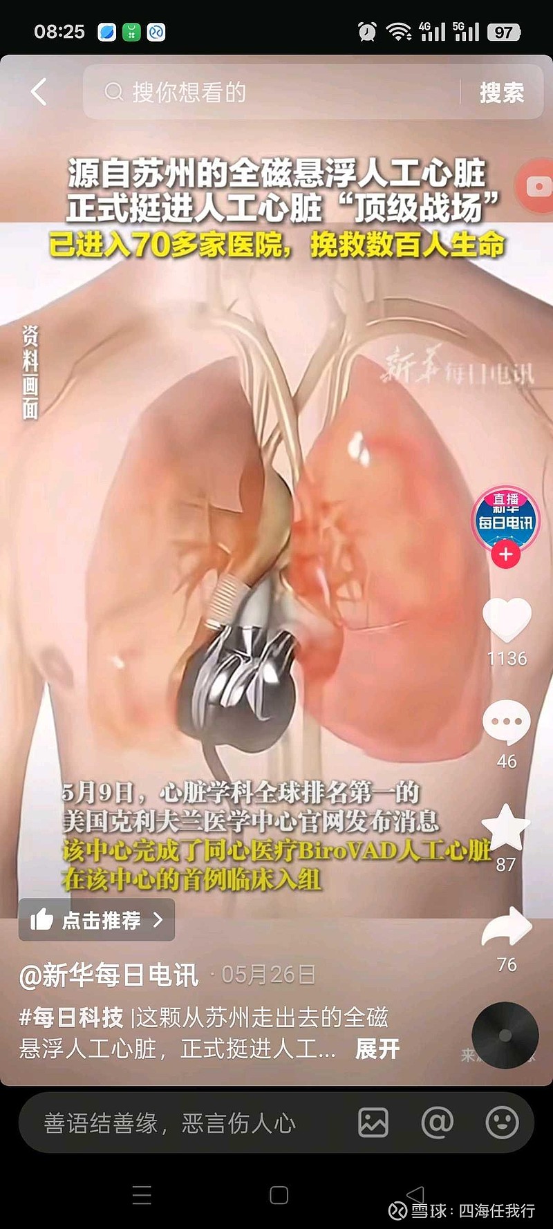 蓝帆医疗：预期手套业务将从2025年大幅亏损转向2026年明显盈利