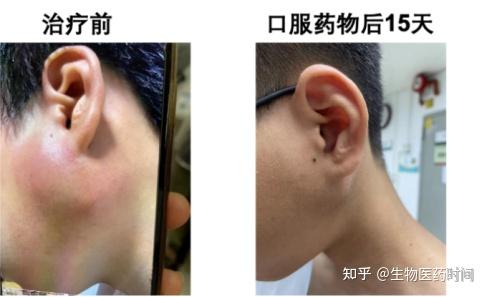 百利天恒(688506.SH)：BL-ARC002用于晚期实体瘤治疗获得临床试验批准通知书